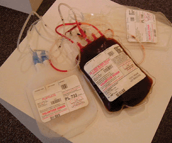 Image: Donor Blood Separation (Photo courtesy of Puget Sound Blood Center).